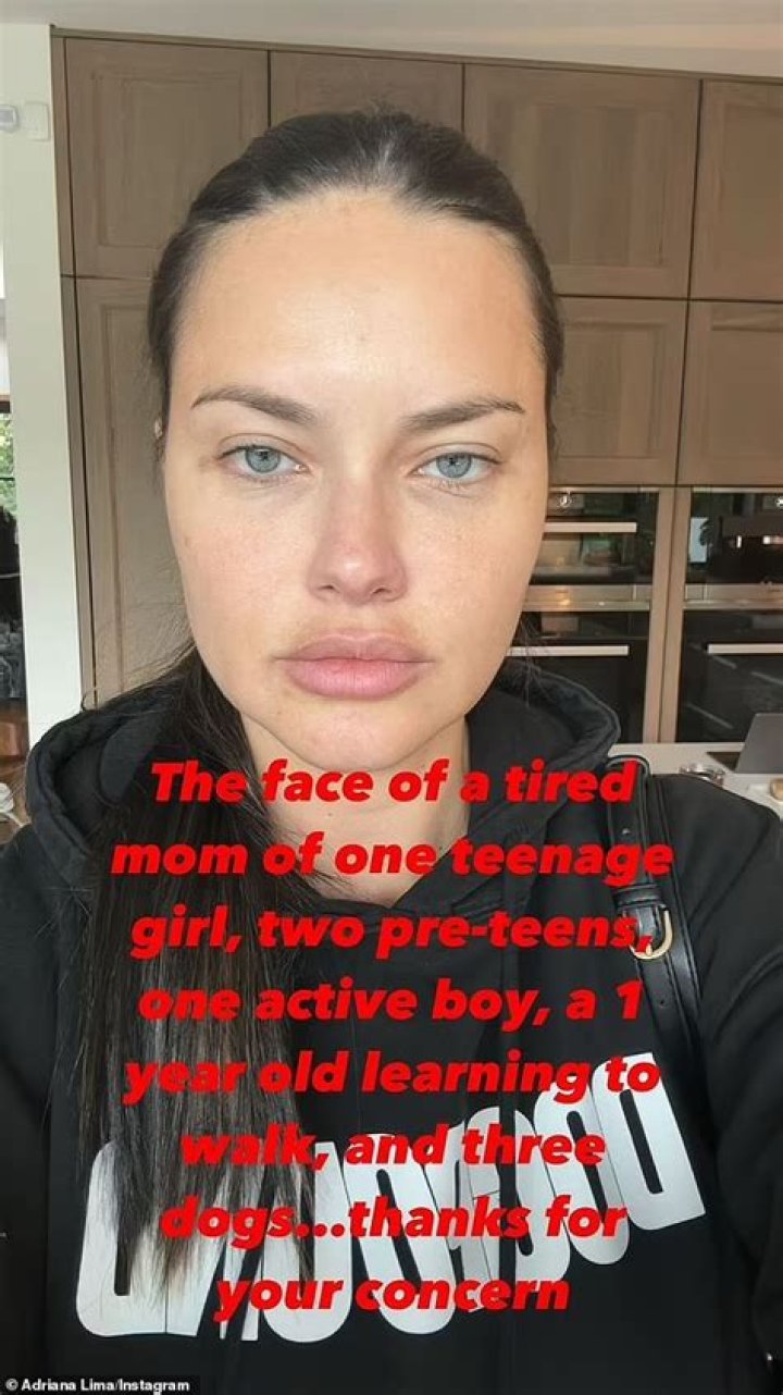 Adriana Lima's Top Falling Moment: A Spotlight on the Iconic Incident