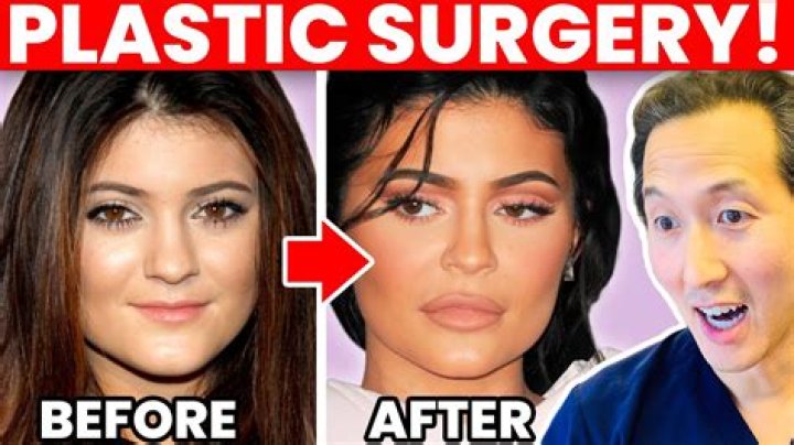Bianca Censori Before and After Plastic Surgery: The Transformation Journey