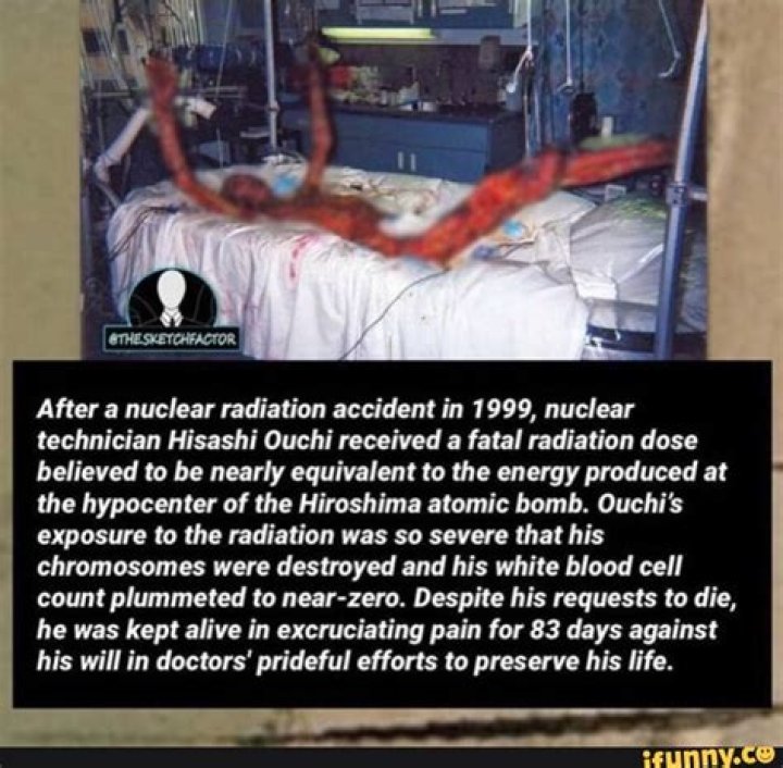 Hisashi Ouchi After Radiation: The Untold Story of Survival and Science
