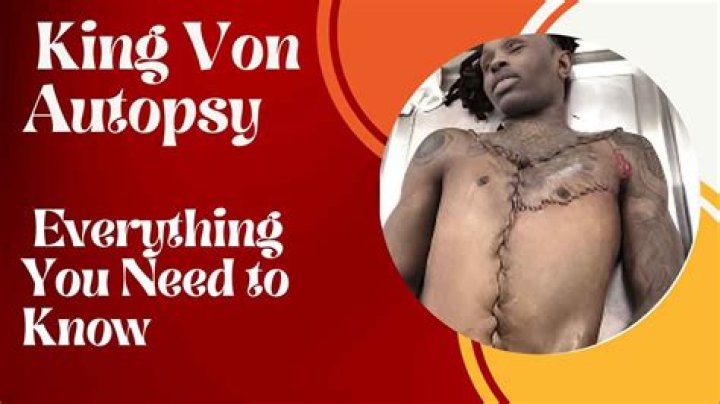 King Von Autopsy: A Detailed Analysis and Insights
