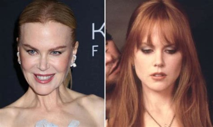 Nicole Kidman Botox: The Truth Behind the Rumors